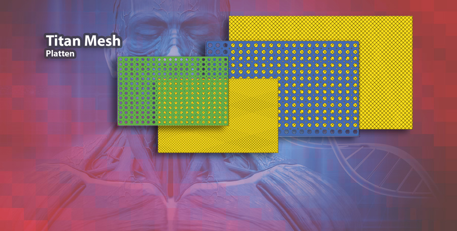 Titan Mesh Platten Titan Mesh Platten
